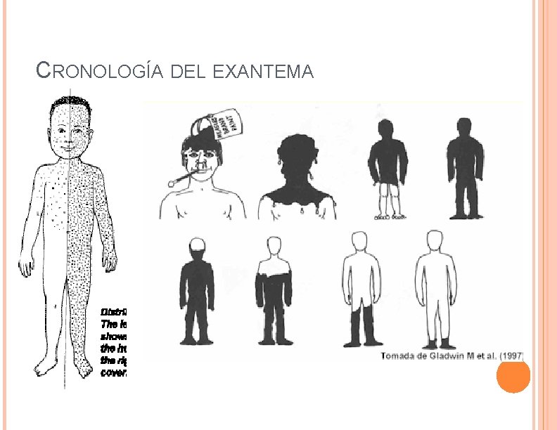 CRONOLOGÍA DEL EXANTEMA 