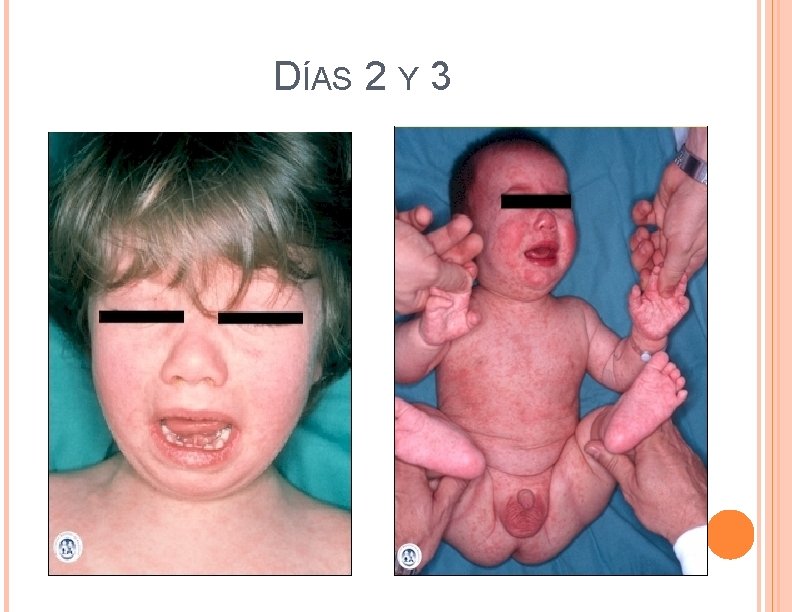 DÍAS 2 Y 3 