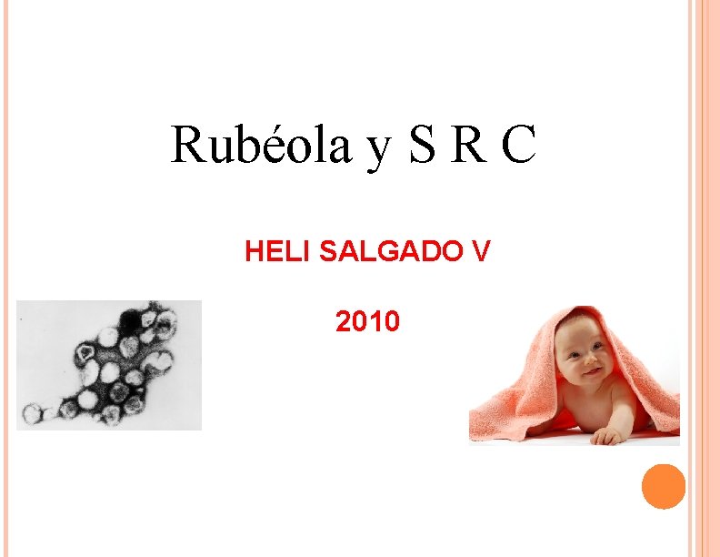 Rubéola y S R C HELI SALGADO V 2010 