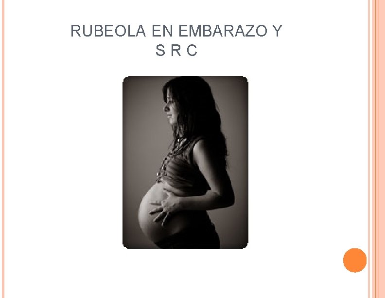 RUBEOLA EN EMBARAZO Y S R C 