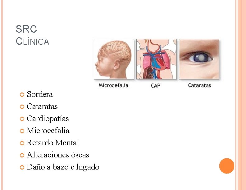 SRC CLÍNICA Sordera Cataratas Cardiopatías Microcefalia Retardo Mental Alteraciones óseas Daño a bazo e