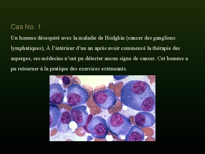 Cas No. 1 Un homme désespéré avec la maladie de Hodgkin (cancer des ganglions Cas No. 1 Un homme désespéré avec la maladie de Hodgkin (cancer des ganglions