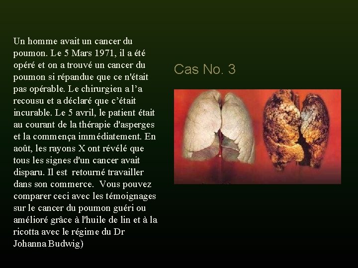 Un homme avait un cancer du poumon. Le 5 Mars 1971, il a été Un homme avait un cancer du poumon. Le 5 Mars 1971, il a été