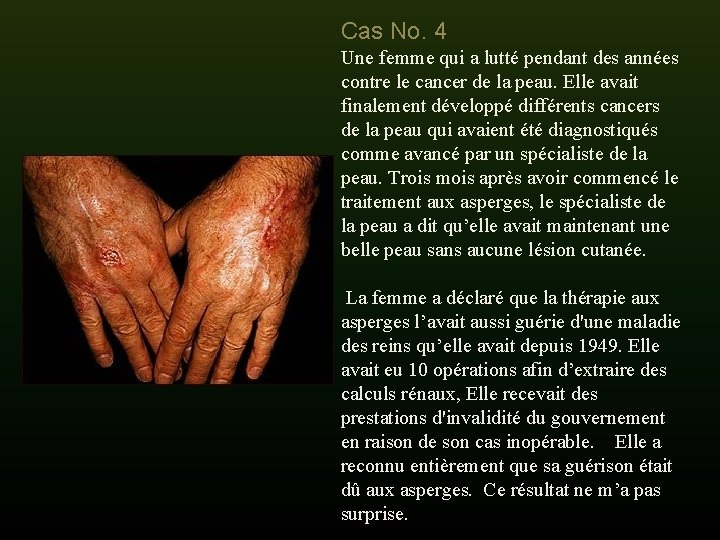 Cas No. 4 Une femme qui a lutté pendant des années contre le cancer Cas No. 4 Une femme qui a lutté pendant des années contre le cancer