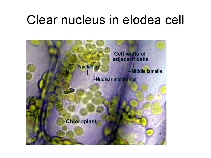Clear nucleus in elodea cell 