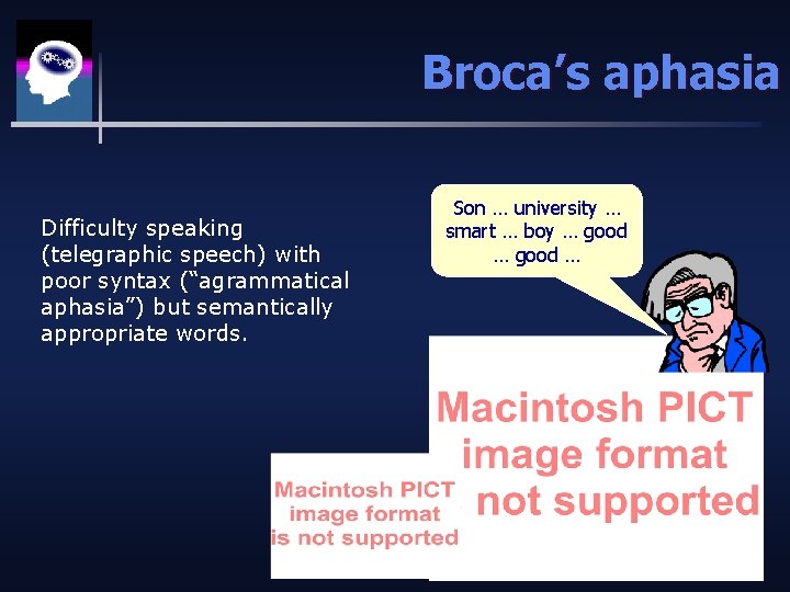 Broca’s aphasia Difficulty speaking (telegraphic speech) with poor syntax (“agrammatical aphasia”) but semantically appropriate