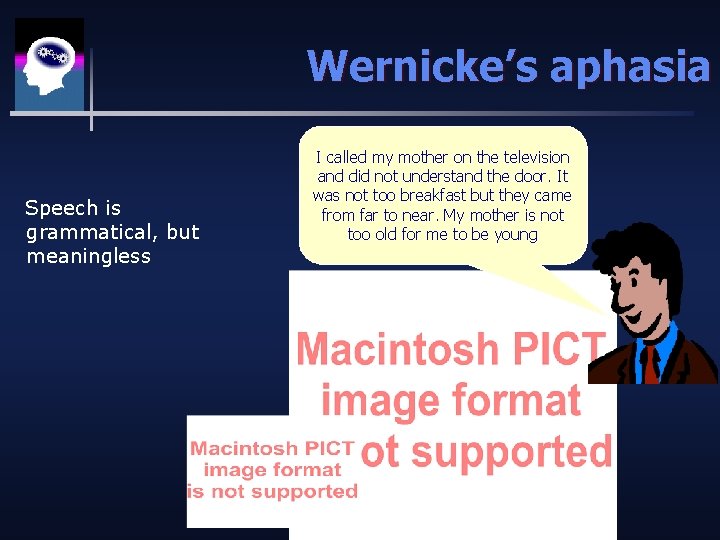 Wernicke’s aphasia Speech is grammatical, but meaningless I called my mother on the television