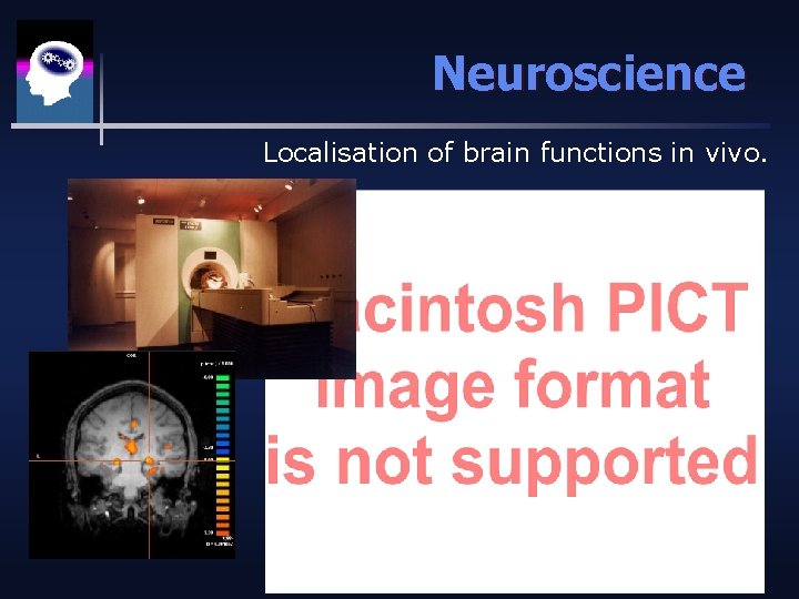 Neuroscience Localisation of brain functions in vivo. 