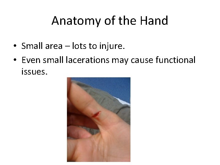 Anatomy of the Hand • Small area – lots to injure. • Even small