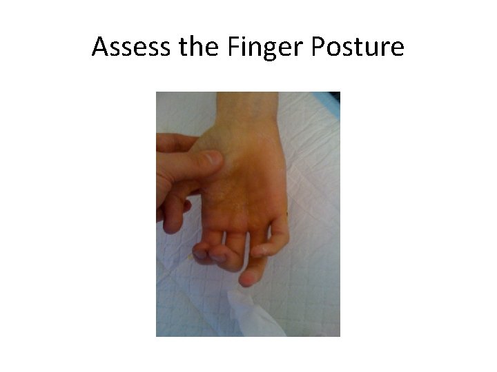 Assess the Finger Posture 