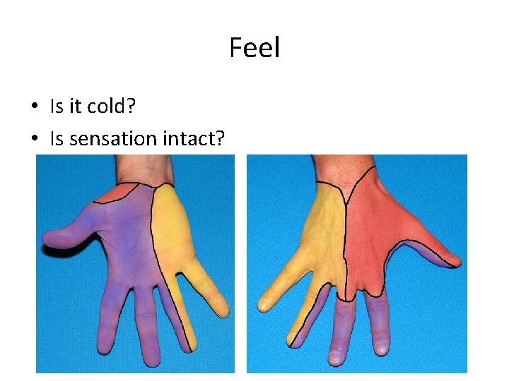 Feel • Is it cold? • Is sensation intact? 