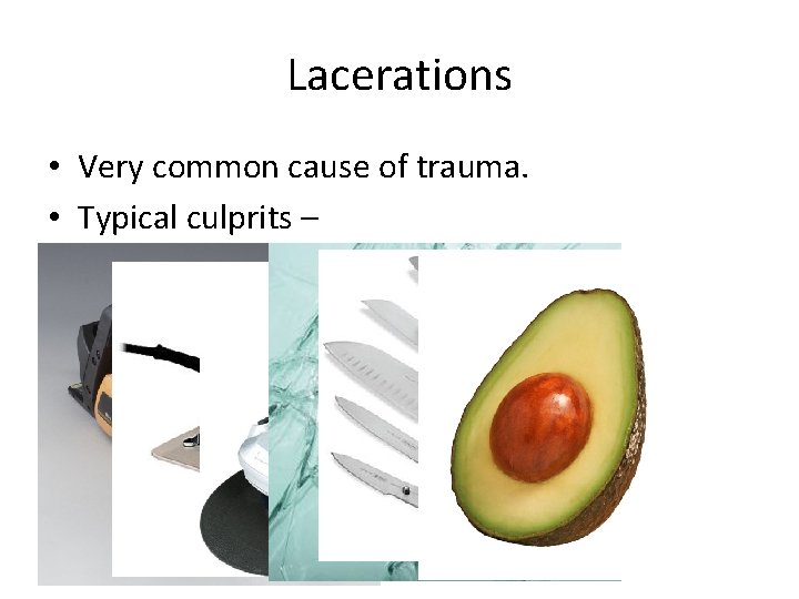 Lacerations • Very common cause of trauma. • Typical culprits – 