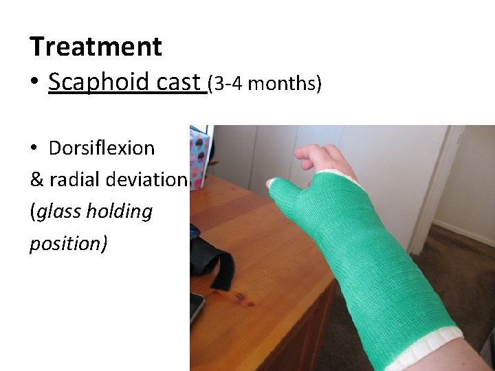 Treatment • Scaphoid cast (3 -4 months) • Dorsiflexion & radial deviation (glass holding