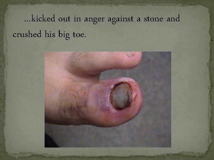 …kicked out in anger against a stone and crushed his big toe. …kicked out in anger against a stone and crushed his big toe.