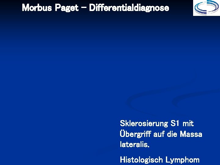 Morbus Paget - Differentialdiagnose Sklerosierung S 1 mit Übergriff auf die Massa lateralis. Histologisch