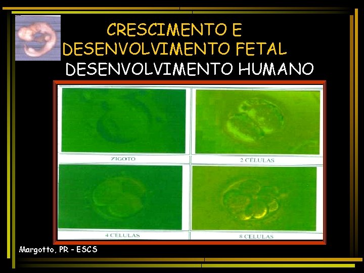 CRESCIMENTO E DESENVOLVIMENTO FETAL DESENVOLVIMENTO HUMANO Margotto, PR - ESCS 