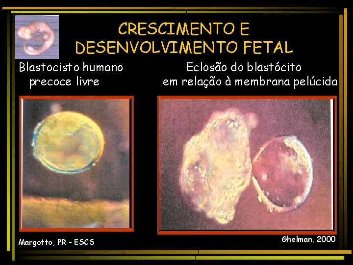 CRESCIMENTO E DESENVOLVIMENTO FETAL Blastocisto humano precoce livre Margotto, PR - ESCS Eclosão do