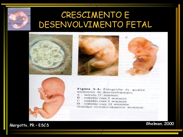 CRESCIMENTO E DESENVOLVIMENTO FETAL Margotto, PR - ESCS Ghelman, 2000 