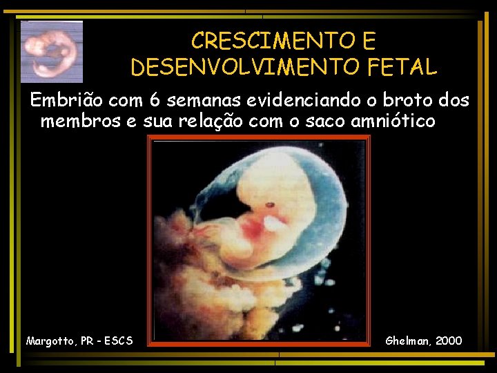 CRESCIMENTO E DESENVOLVIMENTO FETAL Embrião com 6 semanas evidenciando o broto dos membros e