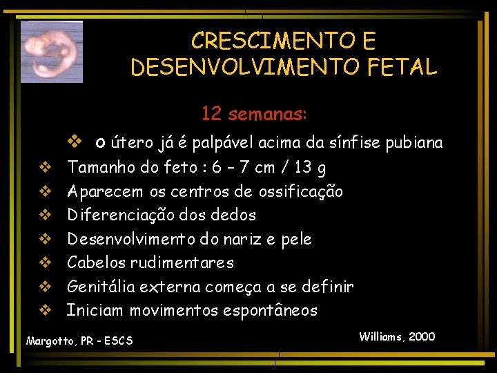 CRESCIMENTO E DESENVOLVIMENTO FETAL 12 semanas: v o útero já é palpável acima da