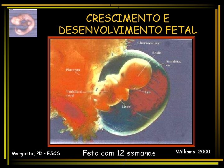 CRESCIMENTO E DESENVOLVIMENTO FETAL Margotto, PR - ESCS Feto com 12 semanas Williams, 2000