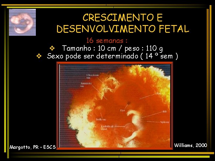 CRESCIMENTO E DESENVOLVIMENTO FETAL 16 semanas : v Tamanho : 10 cm / peso