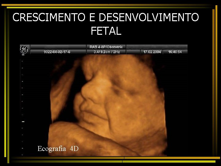 CRESCIMENTO E DESENVOLVIMENTO FETAL Ecografia 4 D 