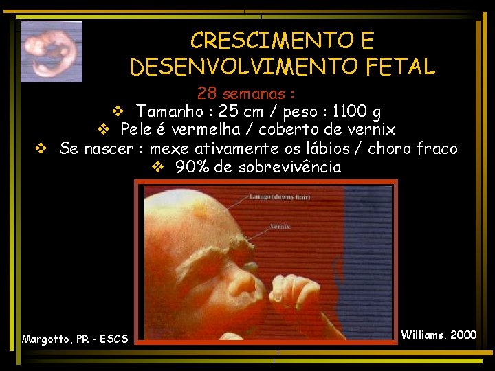 CRESCIMENTO E DESENVOLVIMENTO FETAL 28 semanas : v Tamanho : 25 cm / peso