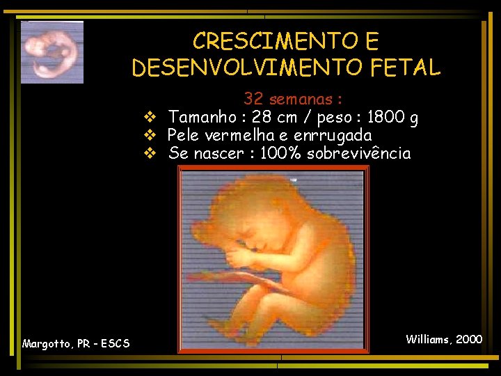 CRESCIMENTO E DESENVOLVIMENTO FETAL 32 semanas : v Tamanho : 28 cm / peso