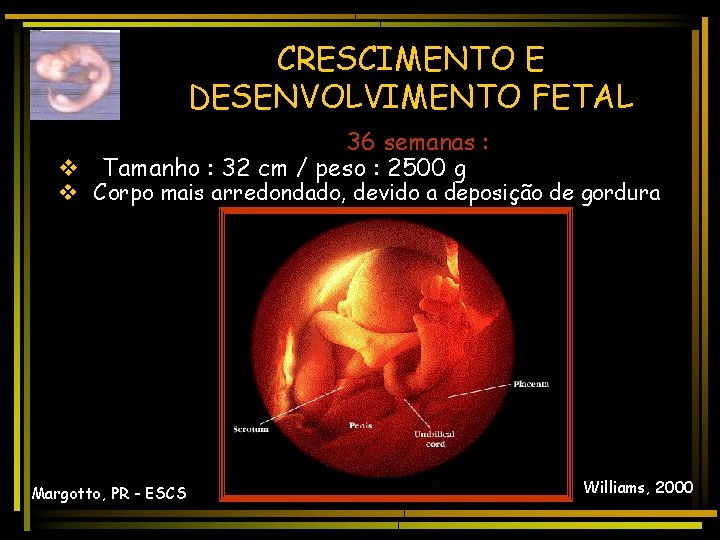 CRESCIMENTO E DESENVOLVIMENTO FETAL 36 semanas : v Tamanho : 32 cm / peso