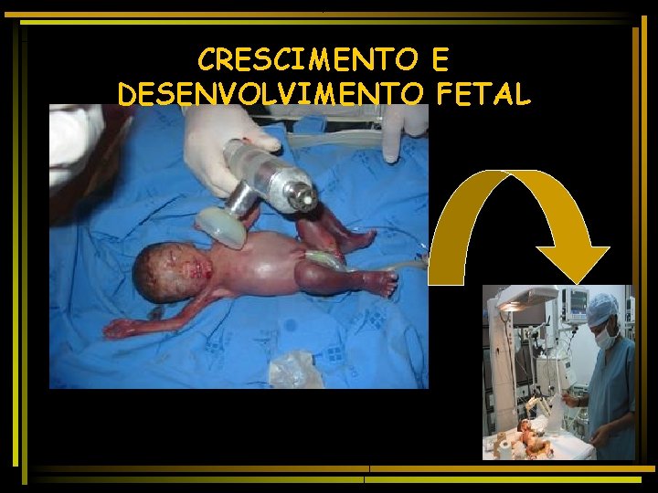 CRESCIMENTO E DESENVOLVIMENTO FETAL 