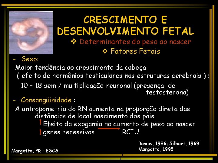 CRESCIMENTO E DESENVOLVIMENTO FETAL v Determinantes do peso ao nascer v Fatores Fetais -