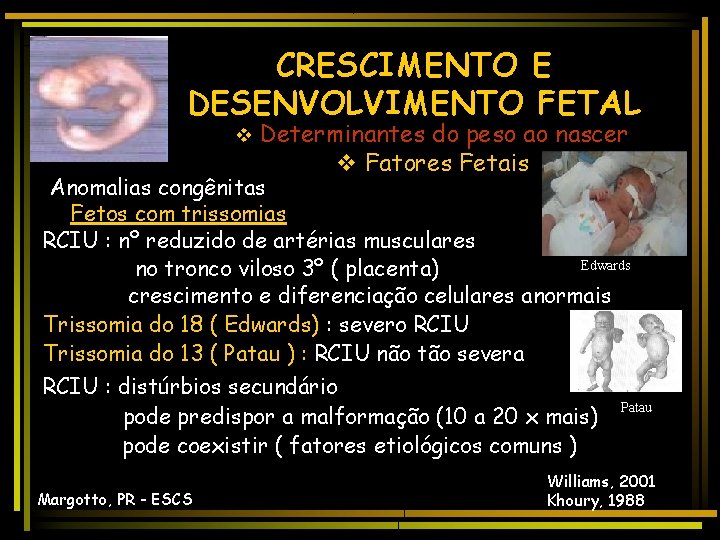 CRESCIMENTO E DESENVOLVIMENTO FETAL v Determinantes do peso ao nascer v Fatores Fetais Anomalias