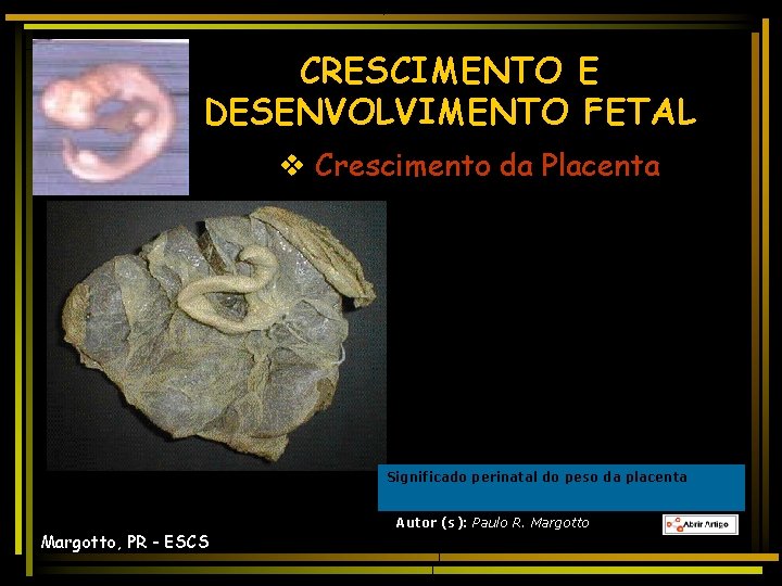 CRESCIMENTO E DESENVOLVIMENTO FETAL v Crescimento da Placenta Significado perinatal do peso da placenta