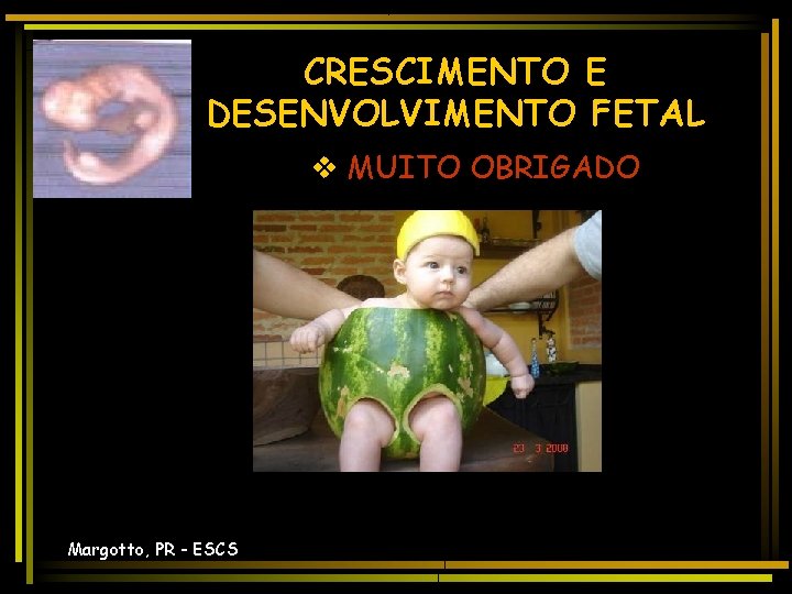 CRESCIMENTO E DESENVOLVIMENTO FETAL v MUITO OBRIGADO Margotto, PR - ESCS 