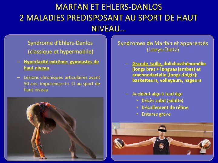 MARFAN ET EHLERS-DANLOS 2 MALADIES PREDISPOSANT AU SPORT DE HAUT NIVEAU… Syndromes de Marfan