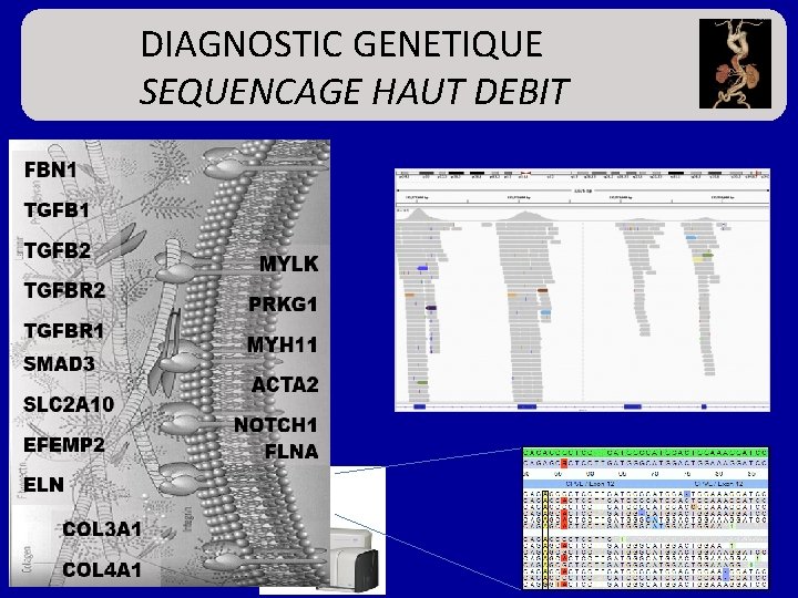 DIAGNOSTIC GENETIQUE SEQUENCAGE HAUT DEBIT Diagnostic « exhaustif » 