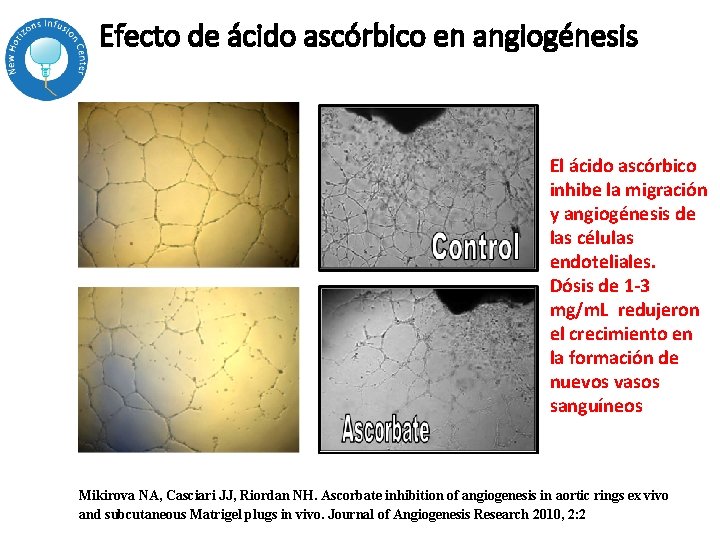 Efecto de ácido ascórbico en angiogénesis El ácido ascórbico inhibe la migración y angiogénesis Efecto de ácido ascórbico en angiogénesis El ácido ascórbico inhibe la migración y angiogénesis