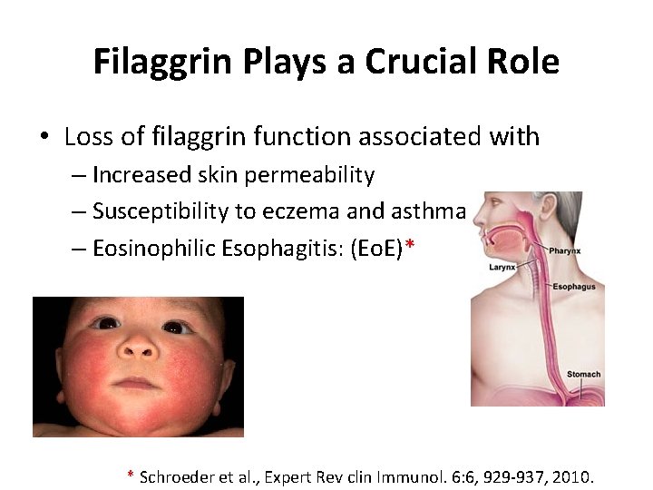 Filaggrin Plays a Crucial Role • Loss of filaggrin function associated with – Increased