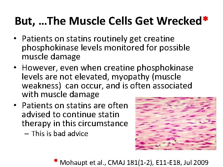 But, …The Muscle Cells Get Wrecked* • Patients on statins routinely get creatine phosphokinase