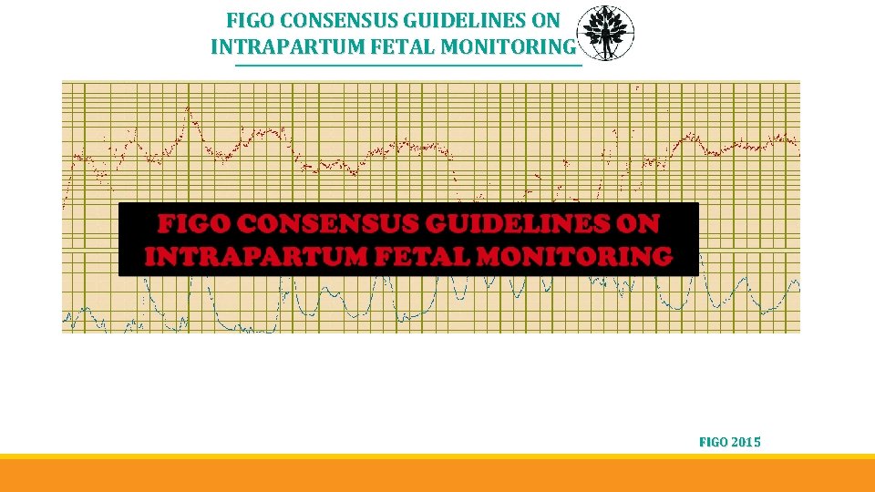 FIGO CONSENSUS GUIDELINES ON INTRAPARTUM FETAL MONITORING FIGO 2015 