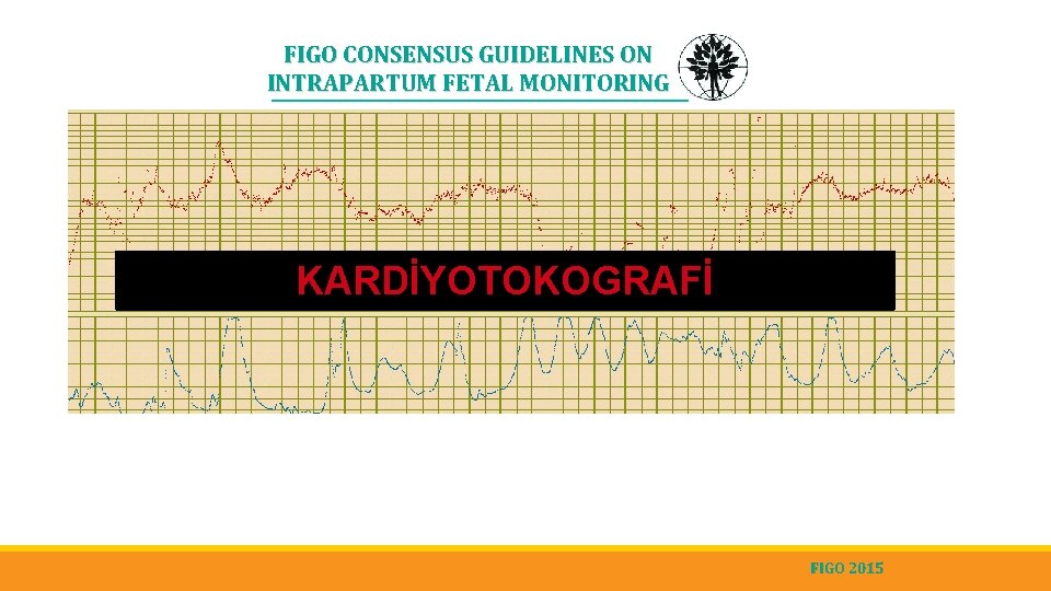 FIGO CONSENSUS GUIDELINES ON INTRAPARTUM FETAL MONITORING KARDİYOTOKOGRAFİ FIGO 2015 