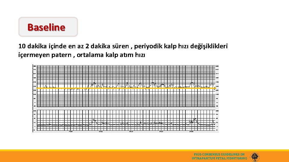 Baseline 10 dakika içinde en az 2 dakika süren , periyodik kalp hızı değişiklikleri