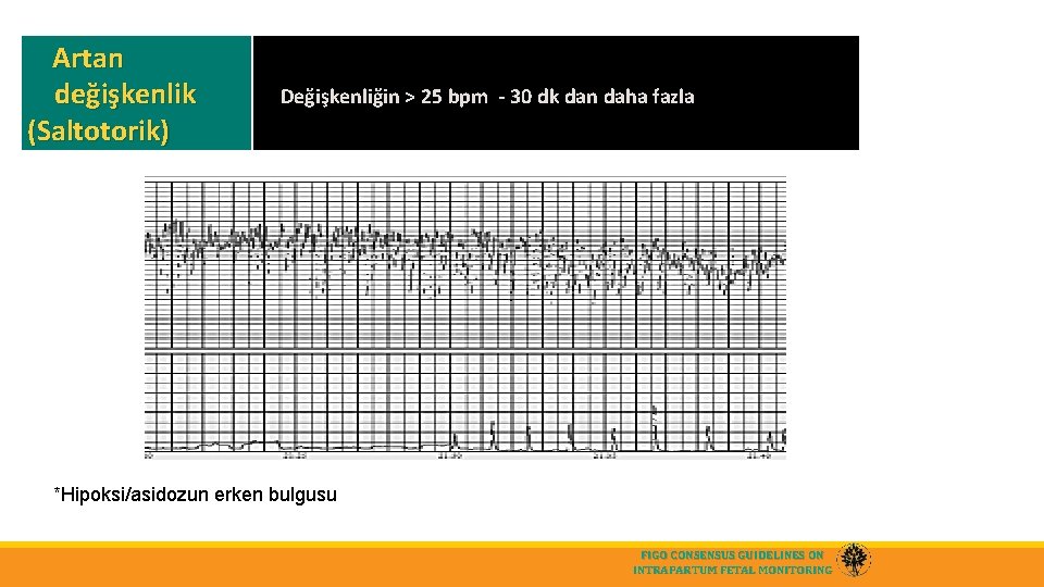 Artan değişkenlik (Saltotorik) Değişkenliğin > 25 bpm - 30 dk dan daha fazla *Hipoksi/asidozun