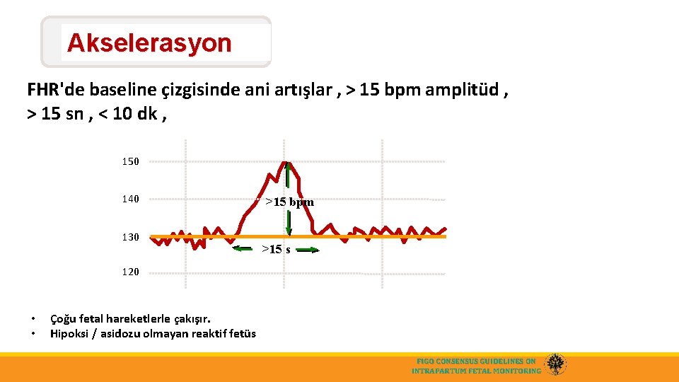 Akselerasyon FHR'de baseline çizgisinde ani artışlar , > 15 bpm amplitüd , > 15