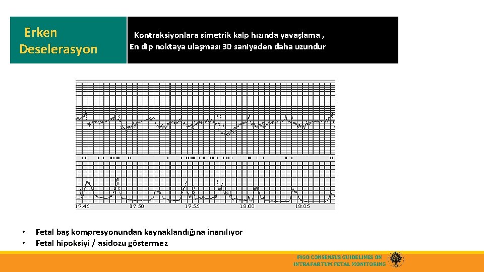 Erken Deselerasyon • • Kontraksiyonlara simetrik kalp hızında yavaşlama , En dip noktaya ulaşması