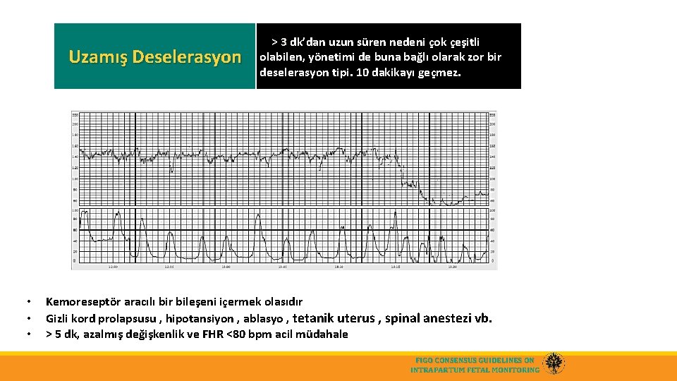 Uzamış Deselerasyon • • • > 3 dk’dan uzun süren nedeni çok çeşitli olabilen,