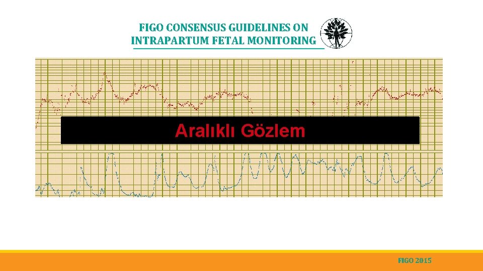 FIGO CONSENSUS GUIDELINES ON INTRAPARTUM FETAL MONITORING Aralıklı Gözlem FIGO 2015 