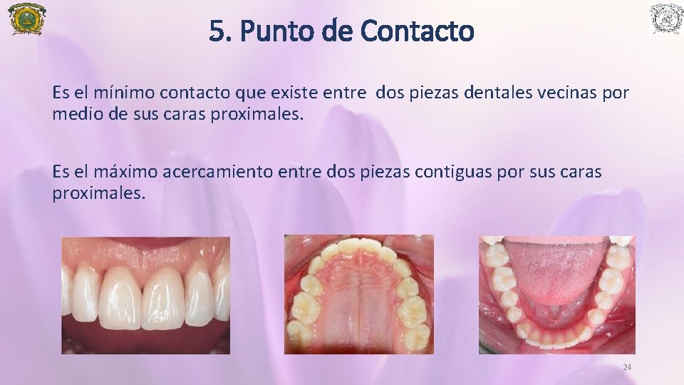 5. Punto de Contacto Es el mínimo contacto que existe entre dos piezas dentales