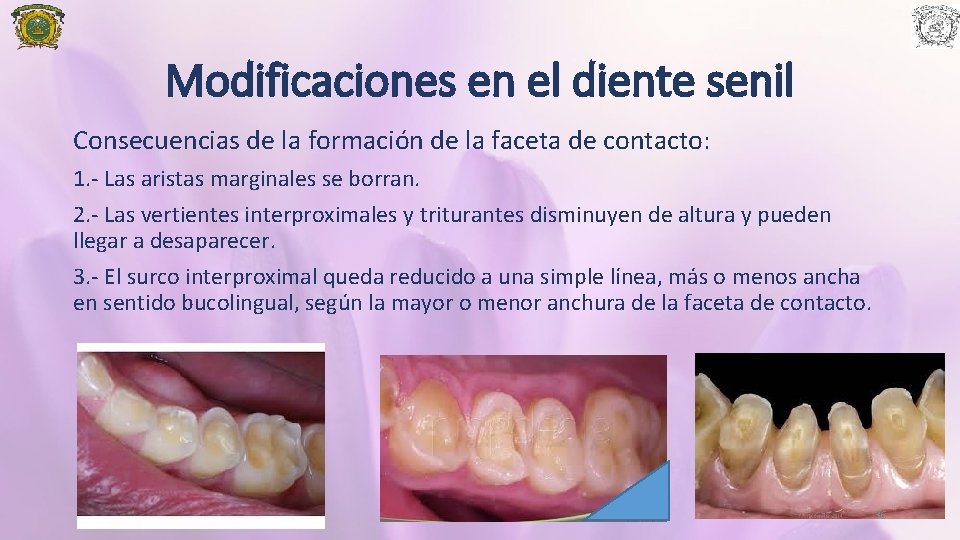 Modificaciones en el diente senil Consecuencias de la formación de la faceta de contacto: